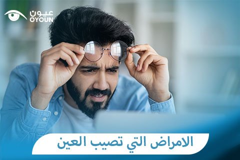الامراض التي تصيب العين