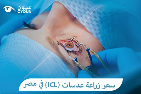 سعر زراعة عدسات icl في مصر